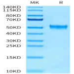 Rat PAI-1 Protein (PAI-RM101)