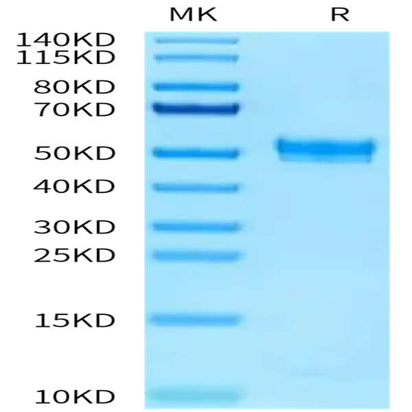 Rat PAI-1 Protein (PAI-RM101)