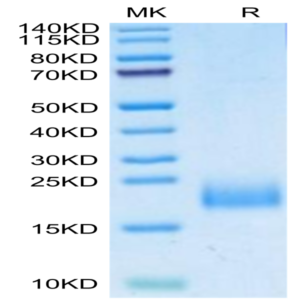 Human uPAR/PLAUR Domain 1 Protein (PAR-HM1D1)