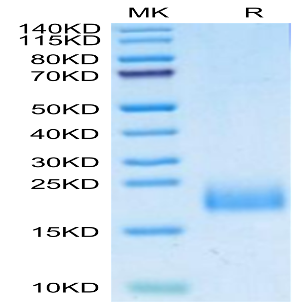 Human uPAR/PLAUR Domain 1 Protein (PAR-HM1D1)