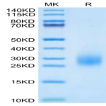 Human uPAR/PLAUR Domain 3 Potein (PAR-HM1D3)