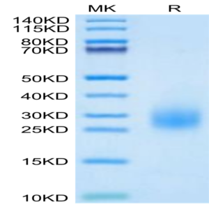 Human uPAR/PLAUR Domain 3 Potein (PAR-HM1D3)