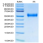 Biotinylated Human uPAR/PLAUR Protein (PAR-HM401B)