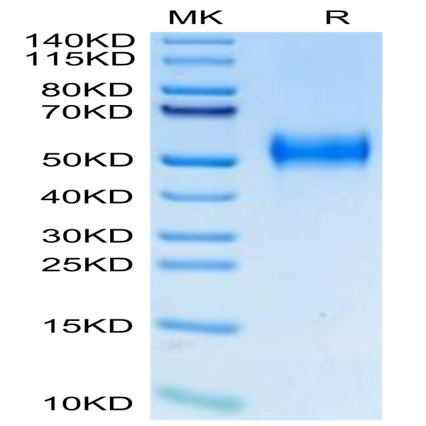 Biotinylated Human uPAR/PLAUR Protein (PAR-HM401B)