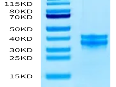 Human PBK/TOPK Protein (PBK-HB101)