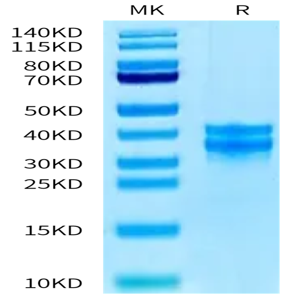 Human PBK/TOPK Protein (PBK-HB101) Human PBK/TOPK Protein (PBK-HB101)