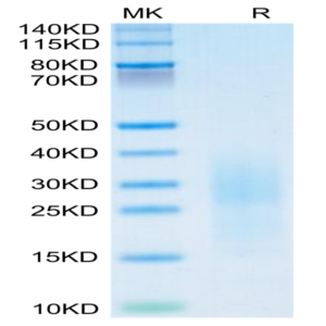 Mouse PSCA Protein (PCA-MM201)