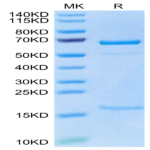 Cynomolgus PCSK9 Protein (PCS-CM190)
