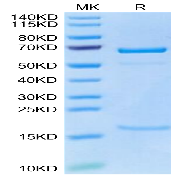Cynomolgus PCSK9 Protein (PCS-CM190)