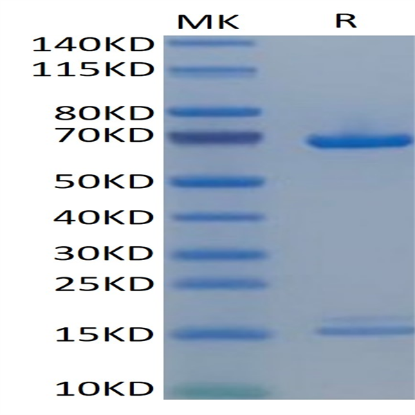 Human PCSK9 Protein (PCS-HM190)