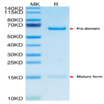 Mouse PCSK9 Protein (PCS-MM190)