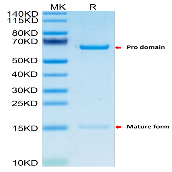 Mouse PCSK9 Protein (PCS-MM190)