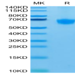 Human PD-1/PDCD1 Protein (PD1-HM301)