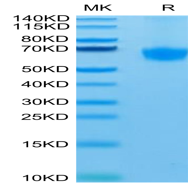 Human PD-1/PDCD1 Protein (PD1-HM301)