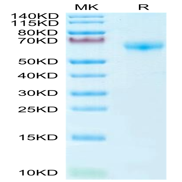 Biotinylated Mouse PD-1/PDCD1 Protein (Primary Amine Labeling) (PD1-MM201B)