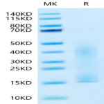 Canine PDGFA Protein (PDF-DY10A)