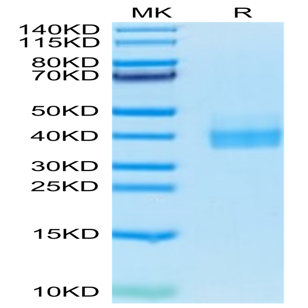 Biotinylated Human PD-L1/B7-H1 Protein (PDL-HM410B)