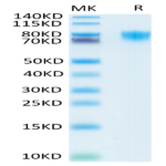 Human PDGF R alpha/PDGFRA Protein (PFR-HM40A)