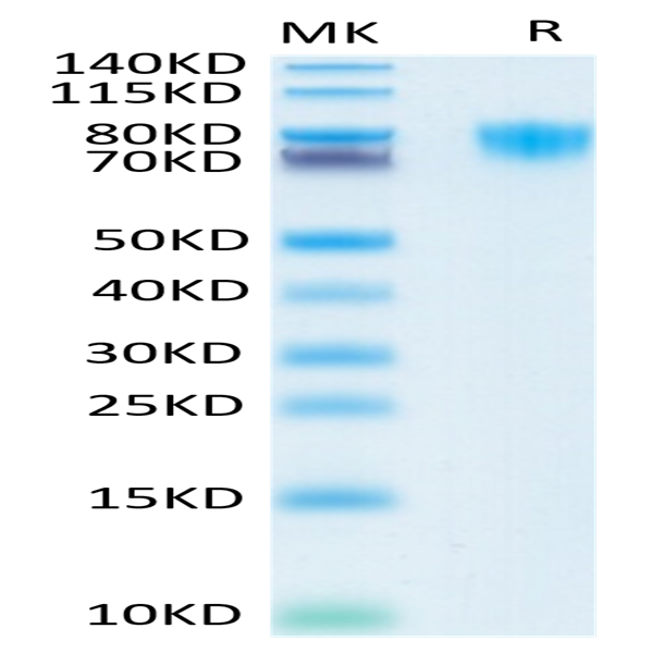 Human PDGF R alpha/PDGFRA Protein (PFR-HM40A)