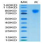 Biotinylated Human PDGF R alpha/PDGFRA Protein (PFR-HM40AB)