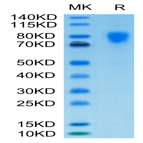 Biotinylated Human PDGF R alpha/PDGFRA Protein (PFR-HM40AB)