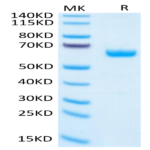 Human PGF Protein (PGF-HM201)