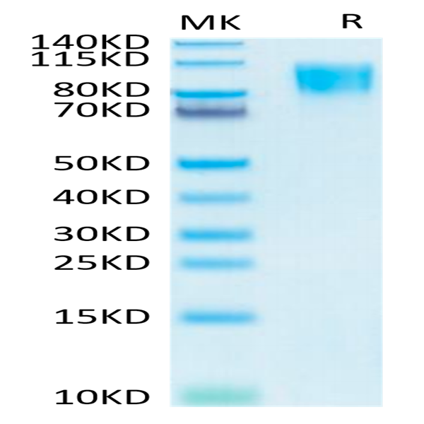 Human PDGF R beta/CD140b Protein (PGF-HM4RB)