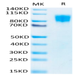 Biotinylated Human PDGF R beta/CD140b Protein (PGF-HM4RBB)