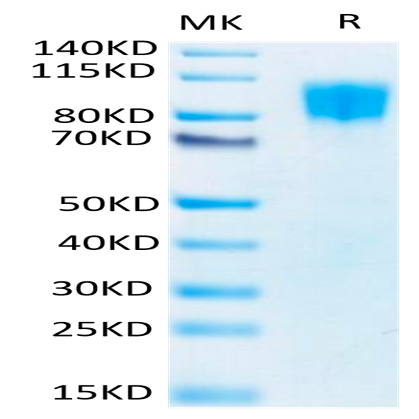 Biotinylated Human PDGF R beta/CD140b Protein (PGF-HM4RBB)