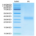 Mouse PGF Protein (PGF-MM101)