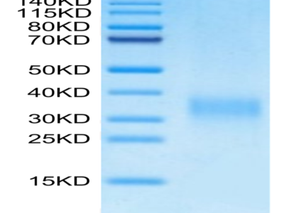 Mouse PGF Protein (PGF-MM101)