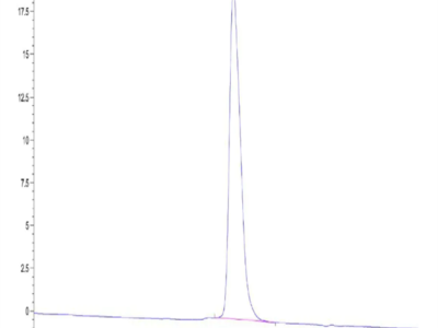 Rat PDGF R beta/CD140b Protein (PGF-RM1RB)