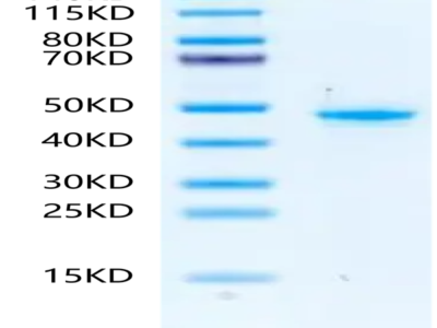 Mouse PGK1 Protein (PGK-MB101)