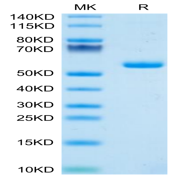 Human PGLYRP1 Protein (PGL-HM201)