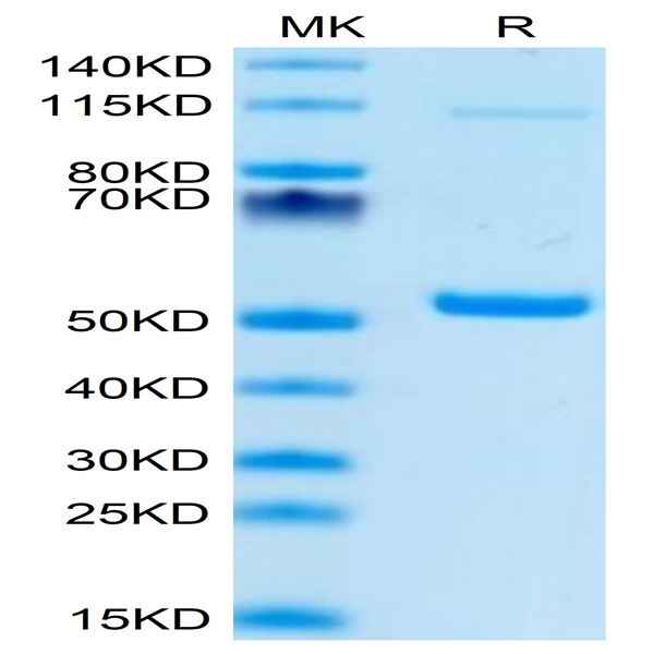 Mouse PGLYRP1 Protein (PGL-MM201)
