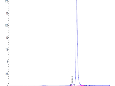 Human PHOSPHO1 Protein (PHO-HE101)