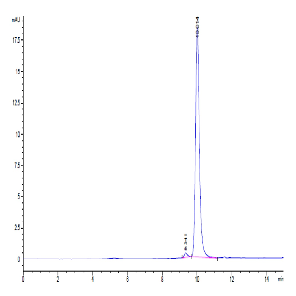 Human PHOSPHO1 Protein (PHO-HE101) Human PHOSPHO1 Protein (PHO-HE101)