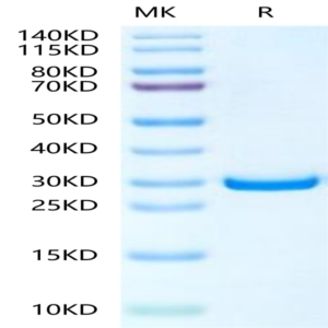 Human PHOSPHO1 Protein (PHO-HE101)