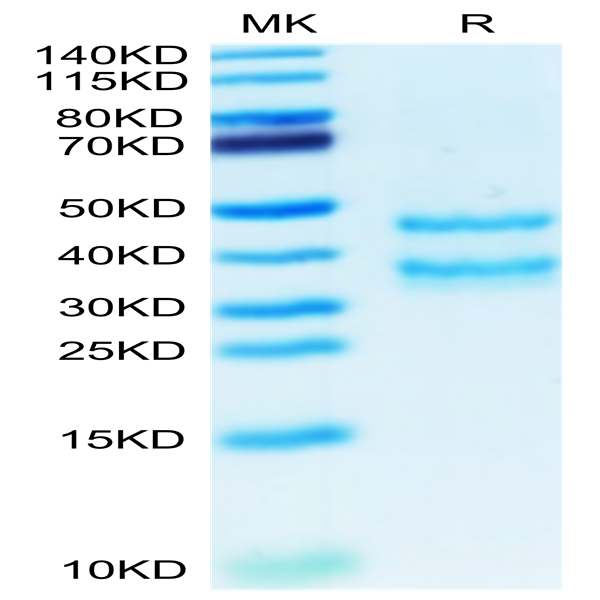 Mouse PK-1/PROK1 Protein (PK1-MM201) Mouse PK-1/PROK1 Protein (PK1-MM201)