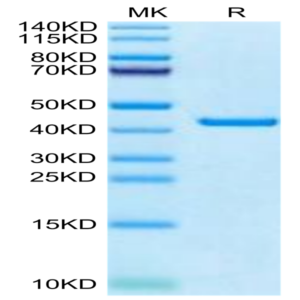 Canine PKA/PRKACA Protein (PKA-DE101)