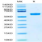 Mouse PKM2 Protein (PKM-MB102)