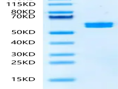 Mouse PKM2 Protein (PKM-MB102)