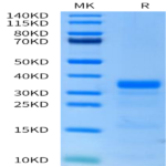 Human PLAU/uPA Protein (active form) (PLA-HM101)