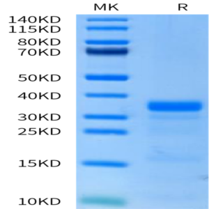 Human PLAU/uPA Protein (active form) (PLA-HM101)