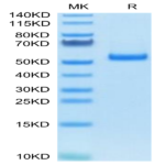 Human PLAU/uPA Protein (pro form) (PLA-HM102)