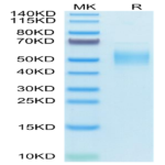 Human PLA2G7 Protein (PLA-HM107)