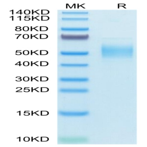 Human PLA2G7 Protein (PLA-HM107)