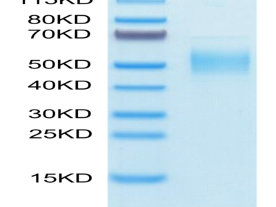 Human PLA2G7 Protein (PLA-HM107)