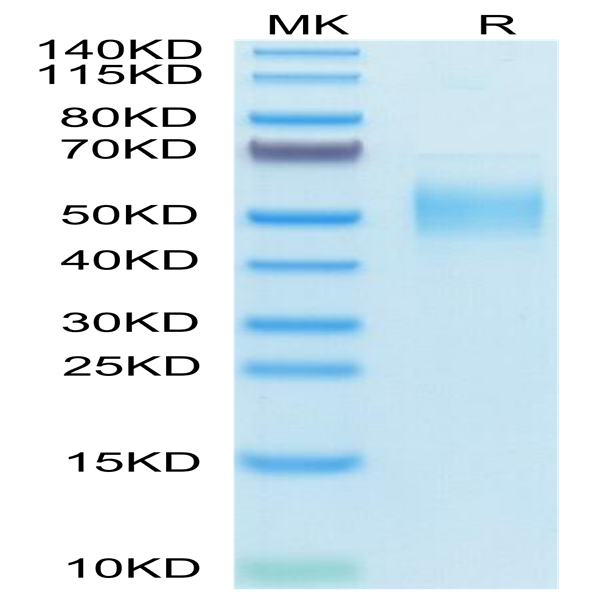 Human PLA2G7 Protein (PLA-HM107) Human PLA2G7 Protein (PLA-HM107)