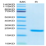 Human PLA2G1B Protein (PLA-HM11B)